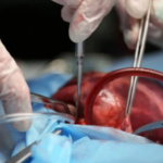 C634B84A-EE7A-416F-BF22-E179D6B80B85